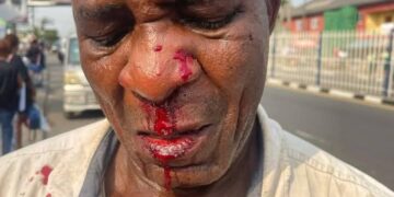 P4P Decries Assault on Minibus Driver, Applauds Mayor’s Swift Action